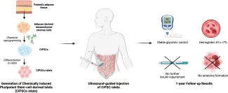 generation-chemically-induced-pluripotent-stem-cell-islets